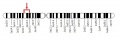 FSHR Gene on chromosome 2 Z3374116 Ref, copyright, student template. FSHR Gene relevant to the section of project where you use this image. You could have also used an image of the receptor in this section.
