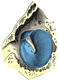 tympanic membrane viewed from within