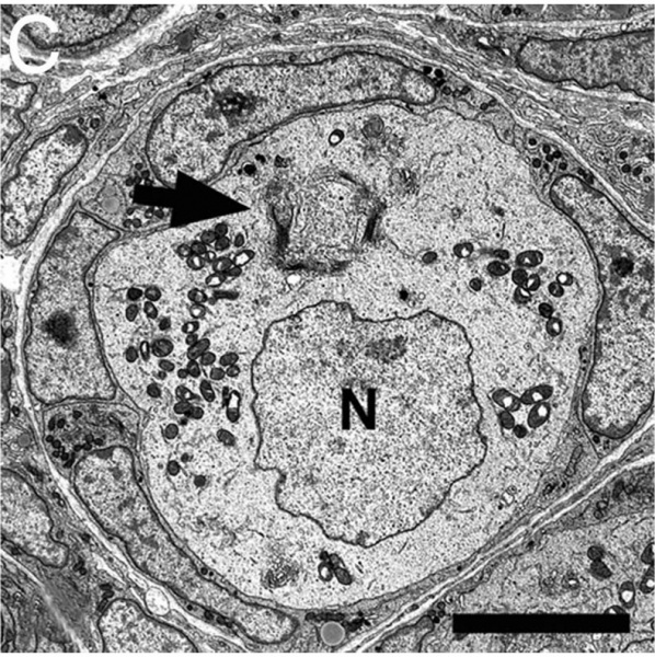 File:Mouse neonatal ovary oocyte EM04.jpg