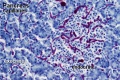 Pancreas histology 004.jpg