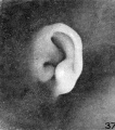 Fig. 37. Embryo No. 2095, 52 mm.