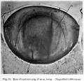 Fig. 14. Eye of embryo pig 10 mm long