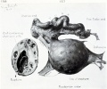 Fig. 157. Drawing of posterior view of pregnant ovary with tube. No. 550. Fig. 158. Transverse section of pregnant ovary cut at point of rupture.