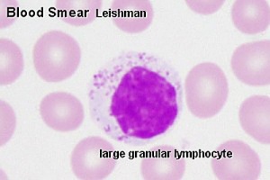 Circulating large granular lymphocyte