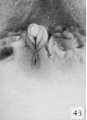 Fig. 43. No. 907, 60 mm., female (perineal view). X 4.