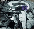 Adult human brain MRI01.jpg