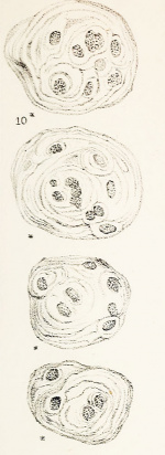 Hassall’s Corpuscles