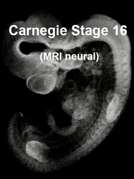 File:Stage16 MRI 3D02 icon.jpg
