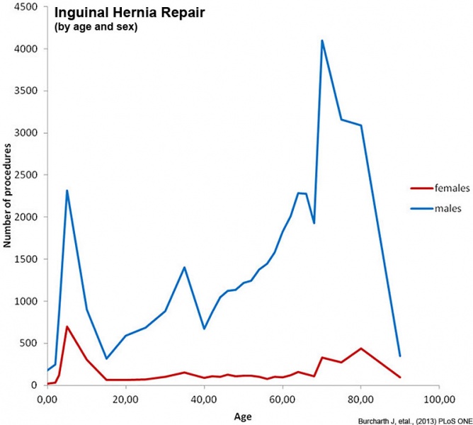 File:Inguinal hernia repair 2.jpg