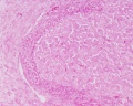 Corpus luteum, theca lutein cells, granulosa lutein cells, x10