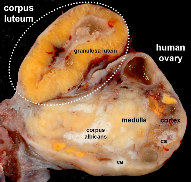 File:Human ovary - corpus luteum 11.jpg