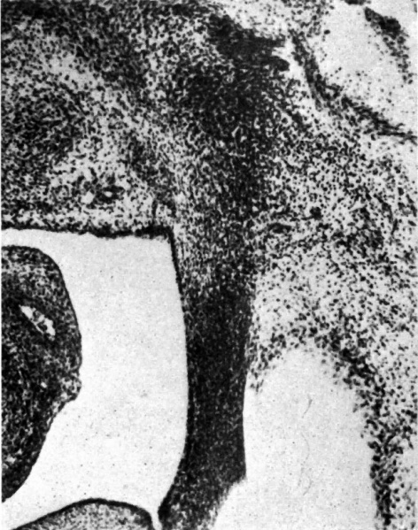 File:Wyndham1943 fig06.jpg