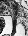 Fig. 6. Gubernaculum detail 20 mm embryo H 304