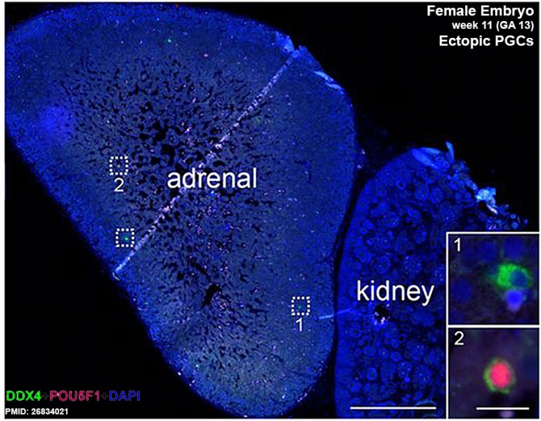 File:Fetal adrenal ectopic germ cells 04.jpg