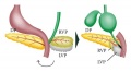 normal pancreatic development fetus Z3418837 Figure relates to normal pancreas development topic and contains reference, copyright and student template. There is no indication that this relates to fetal development (time?). The figure caption does not indentify any of the acronyms used.