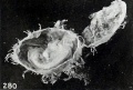 Fig. 280. Tubal conceptus (No. 1151), showing disproportion between the chorionic vesicle and the fetus, sparse development of the villi, and some hydatiform degeneration. Xl.5.