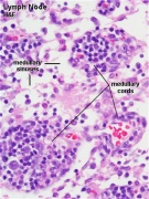 Immune System - Antibody Development - Embryology