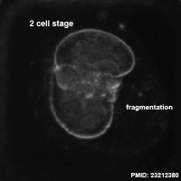 Monosomic embryo 3.jpg