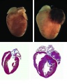 Gross and microscopic view of heart with and without hypertrophy