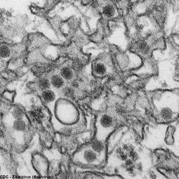 File:Zika virus TEM01.jpg