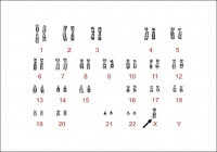 The arrow indicates the presence of only one X chromosome in Karyotype