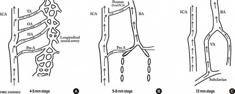 File:Cerebral brain artery development 02.jpg