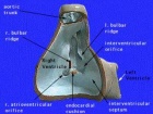 Heart-ventricular-septum-01.jpg