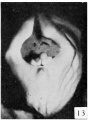 Fig. 13. Carnegie Embryo No. 684, female