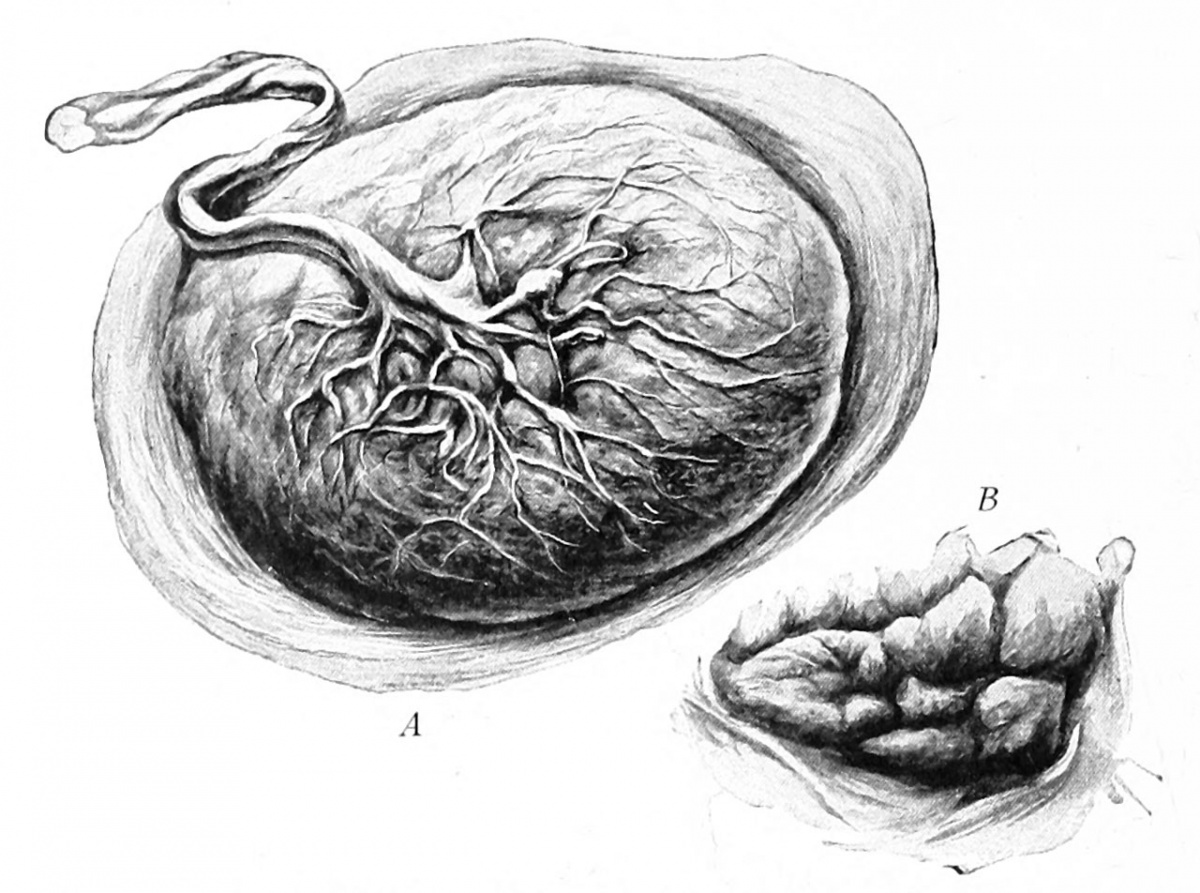 Разрыв плодных. Эмбрион плацента пуповина. Плацента и пуповина анатомия.