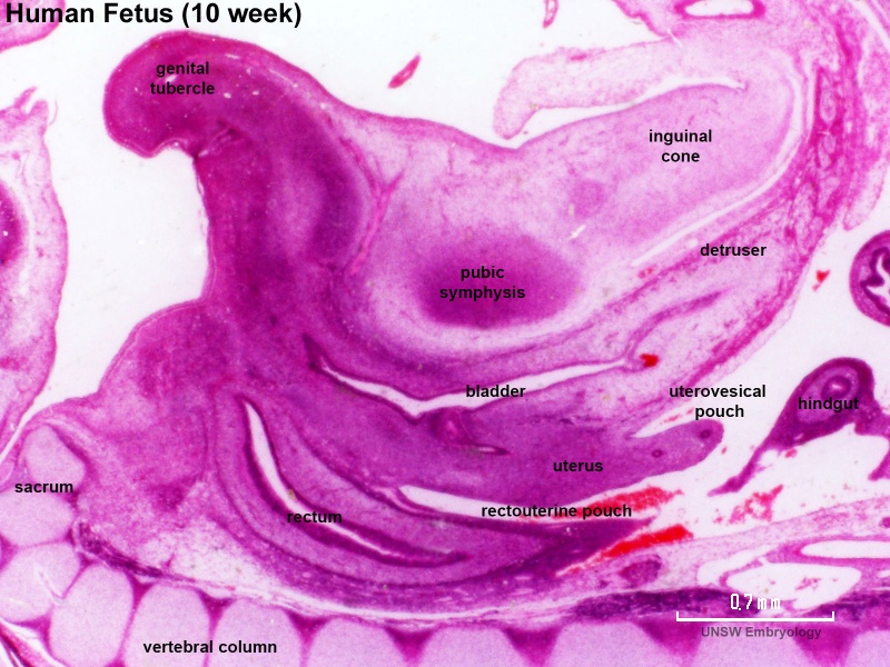 File:Human week 10 fetus 23.jpg