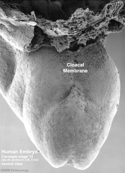 File:Stage12 sem9a cloacal membrane.jpg