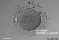 spermatozoa penetrates zona pellucida