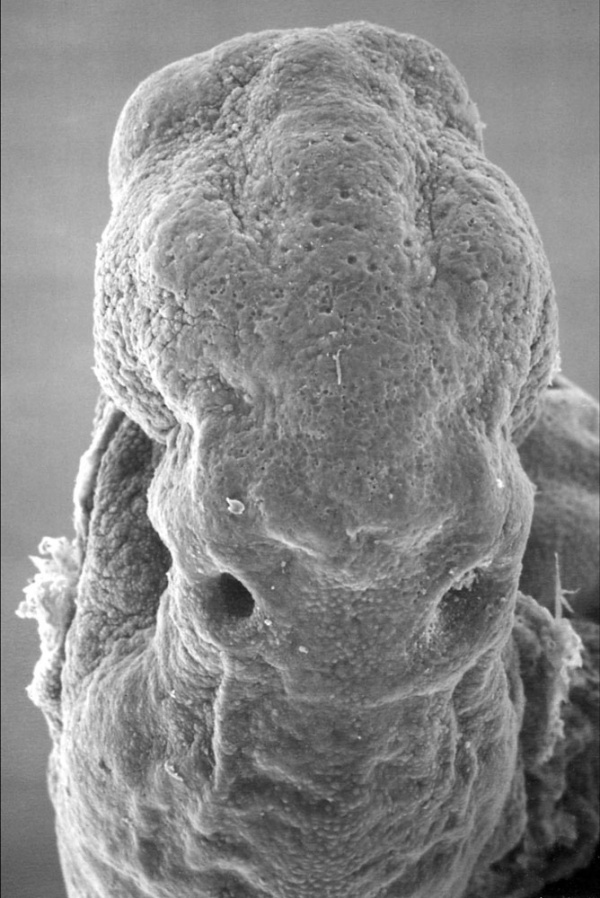 Human embryo stage 11 electron micrograph otic placode
