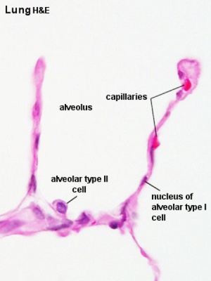 File:Alveolar-sac-01.jpg - Embryology