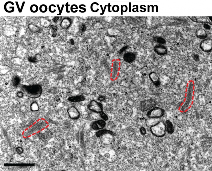 File:Cytoplasmic lattices in GV oocyte cytoplasm.jpg
