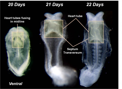 25 day old human embryo