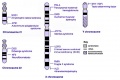 hromosomes 21-XY