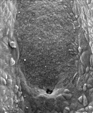 Human Embryo Notochordal Plate