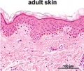 Adult Z3418488 Figure relates to project topic contains reference, copyright and student template. Figure is far to small to see any detailed histology, a better image could have been used here.