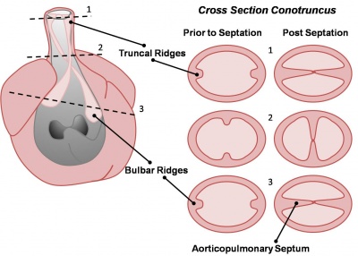 Intermediate - Outflow Tract - Embryology