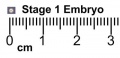Stage 1 size with ruler