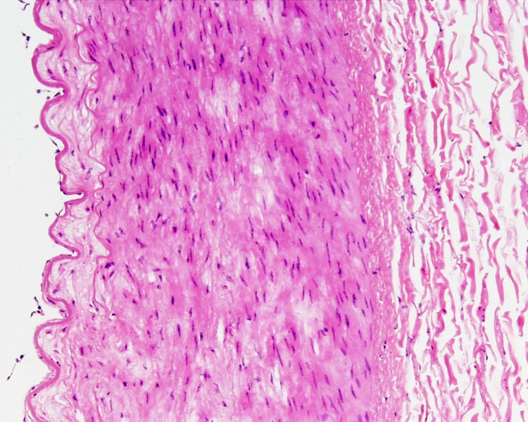 File:Artery histology 11.jpg