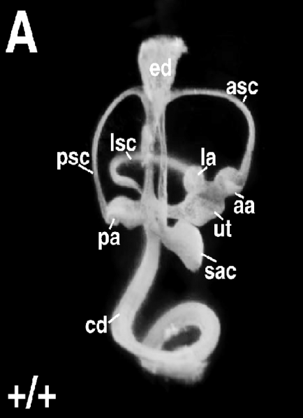 File:Normal cochlea.png