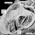 fig 27b Mouse E14.5 heart aortic root