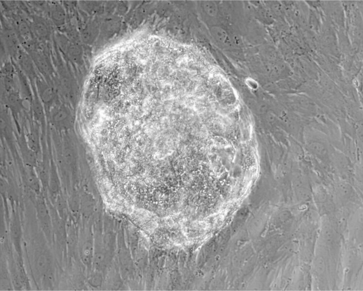 File:Human Blastocyst with Decidualized Endometrial Stromal Cells.png