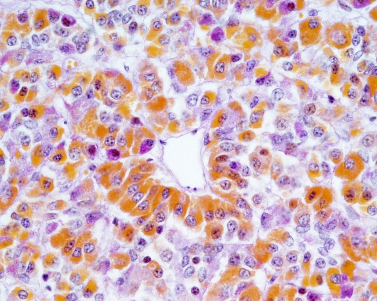 File:Pituitary histology 008.jpg