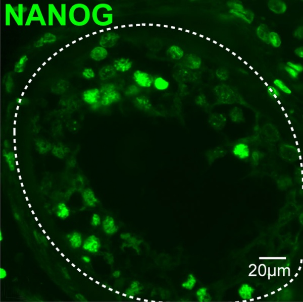 File:Human- spermatozoa NANOG expression 01.jpg