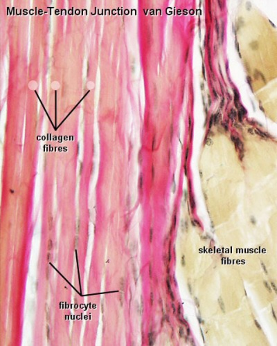 Skeletal muscle histology 044.jpg