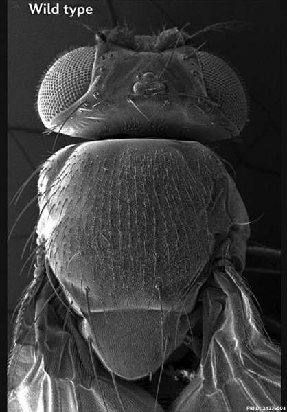 File:Fly WT dorsal view head thorax SEM.jpg