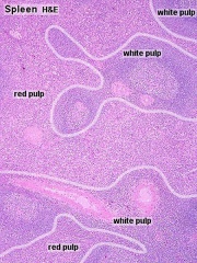 ANAT2241 Lymphatic Tissue and Immune System - Embryology